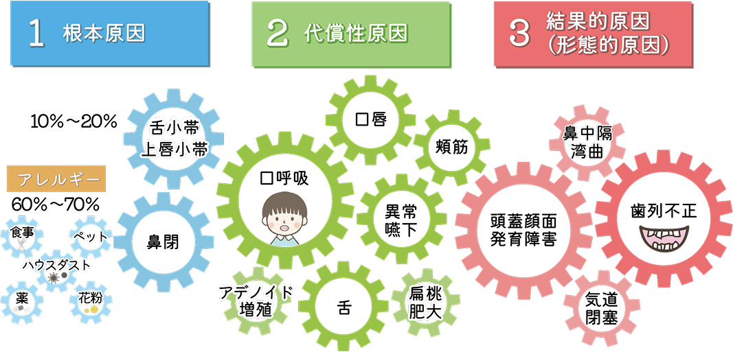 ルートギアモデル