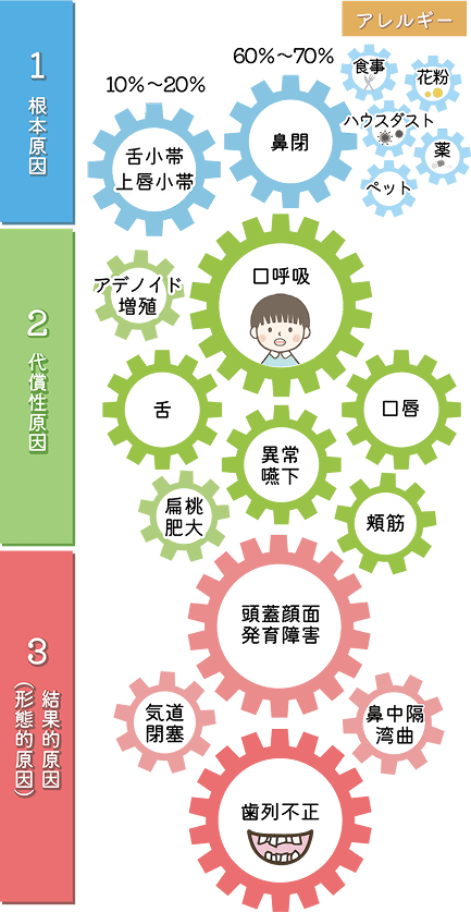 ルートギアモデル